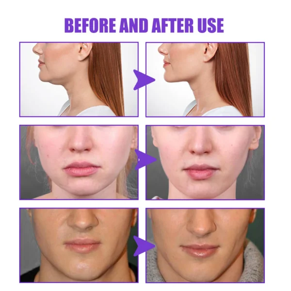 V Shape Slimming Cream Tighten Mandibular line Slimming Masseter Muscle Face Fat Burning Cream Facial Care New - Image 5