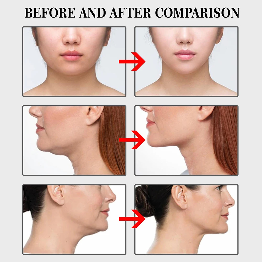 100Pcs Face Lift Invisible Tapes for Face V Line Eyes Lifting Wrinkle Remover Tighten Chin Tape V-Shaped Facial Skin Care Tool - Image 4