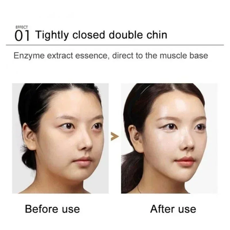 V Shape Slimming Cream Tighten Mandibular line Slimming Masseter Muscle Face Fat Burning Cream Facial Care New - Image 12