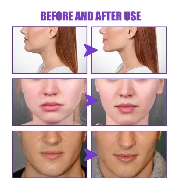 V Shape Slimming Cream Tighten Mandibular line Slimming Masseter Muscle Face Fat Burning Cream Facial Care New - Image 21