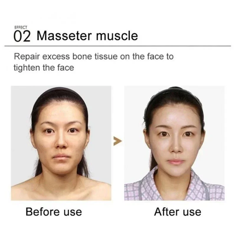 V Shape Slimming Cream Tighten Mandibular line Slimming Masseter Muscle Face Fat Burning Cream Facial Care New - Image 13